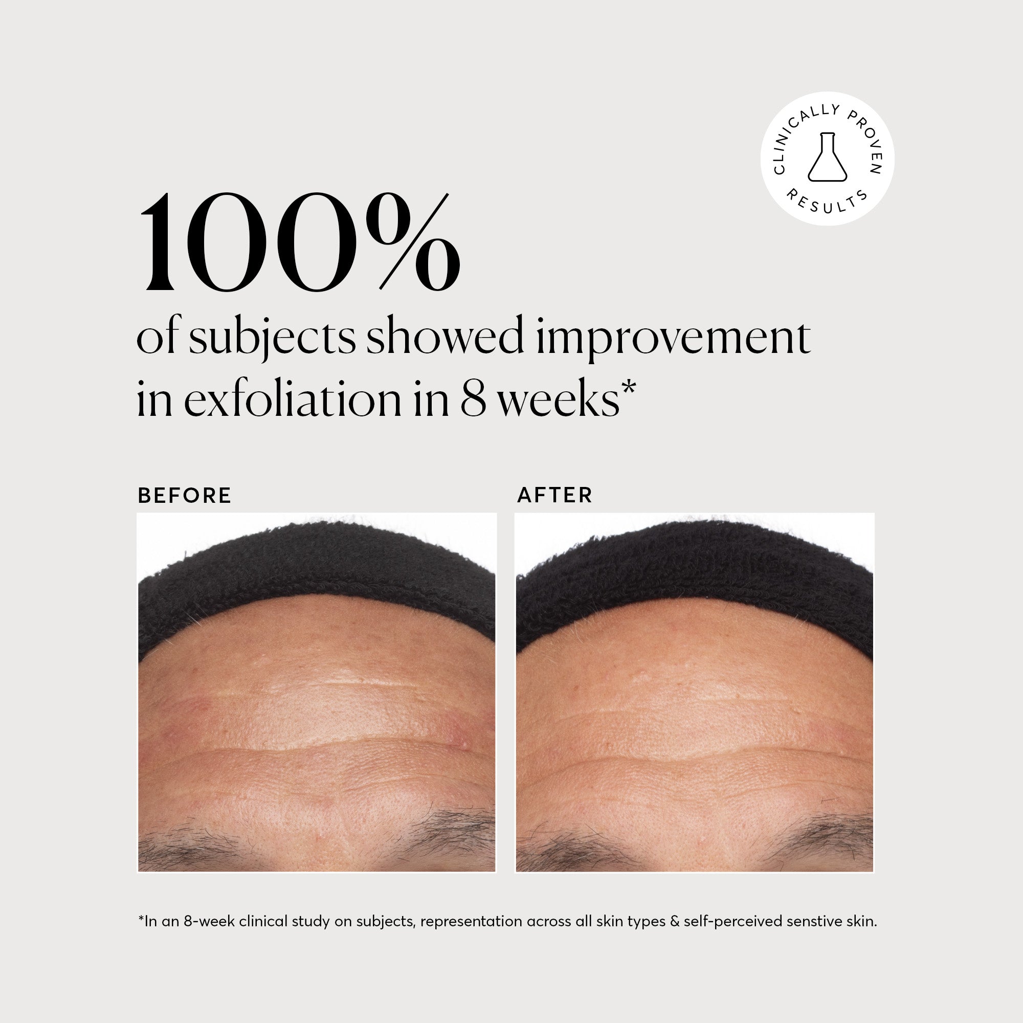 NATR_Azelaic_Acid_Clinical_B_A_Exfoliation_Graphic_1.1_Bone