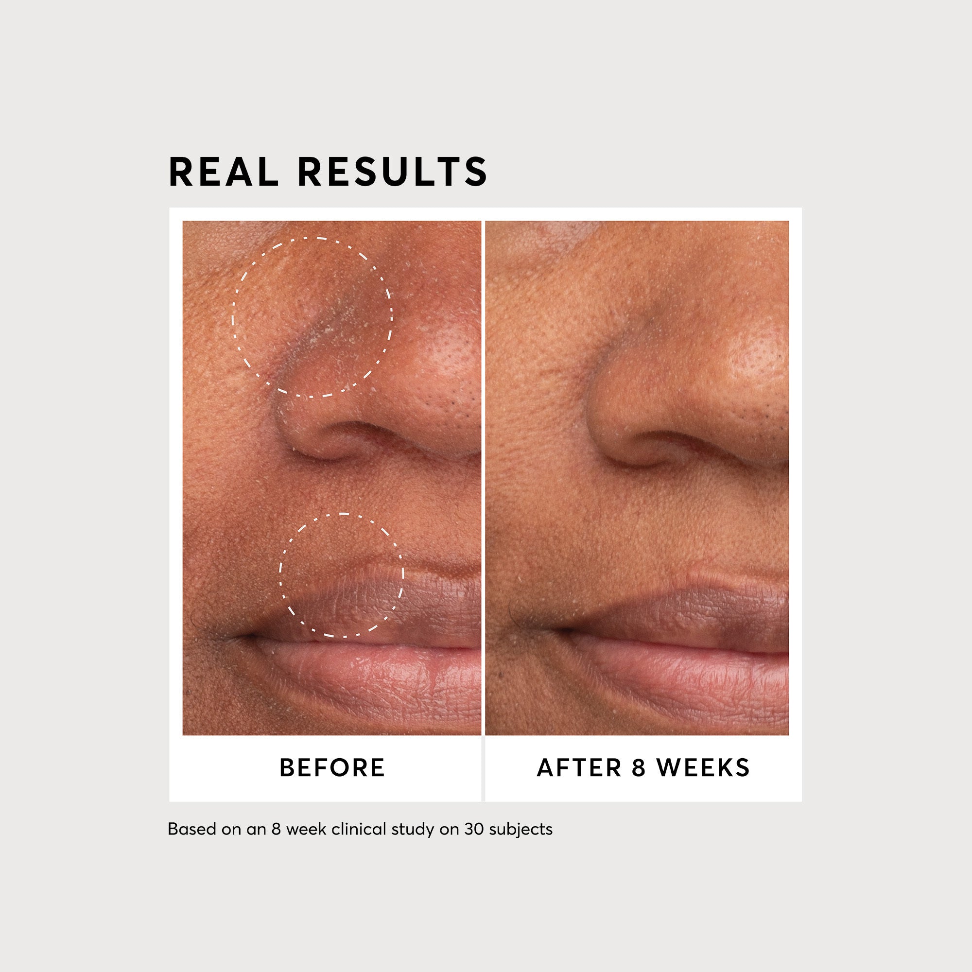 NATR_NiaSerum_Clinicals_PDP_Before-After_1.5