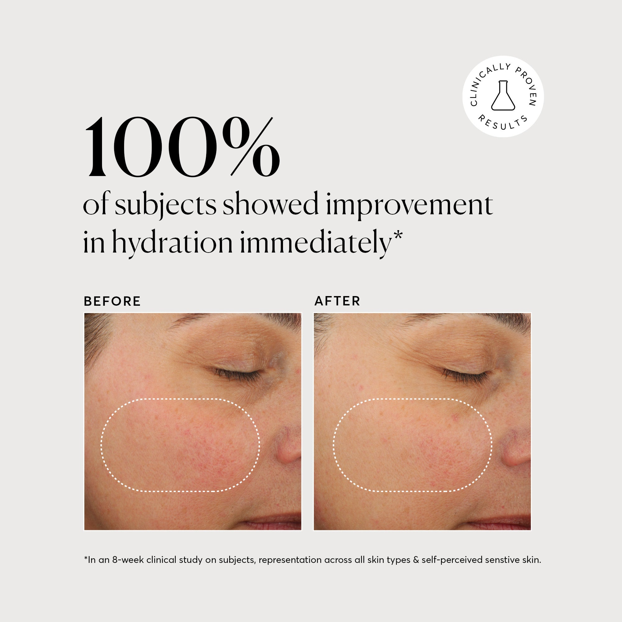 NATR_Plant_Ceramide_Graphics_PackShots_Hydration_813569e8-b8e1-42e6-9e5e-22909cbc0004