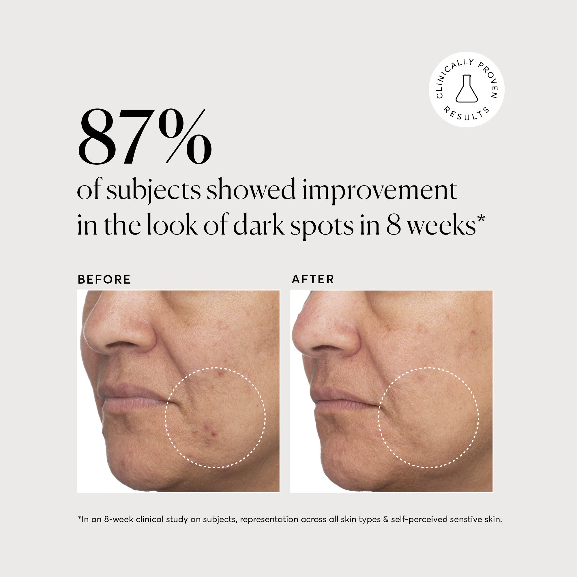 NATR_Tranexamic_Acid_Clinical_Brighter_B_A_Bone