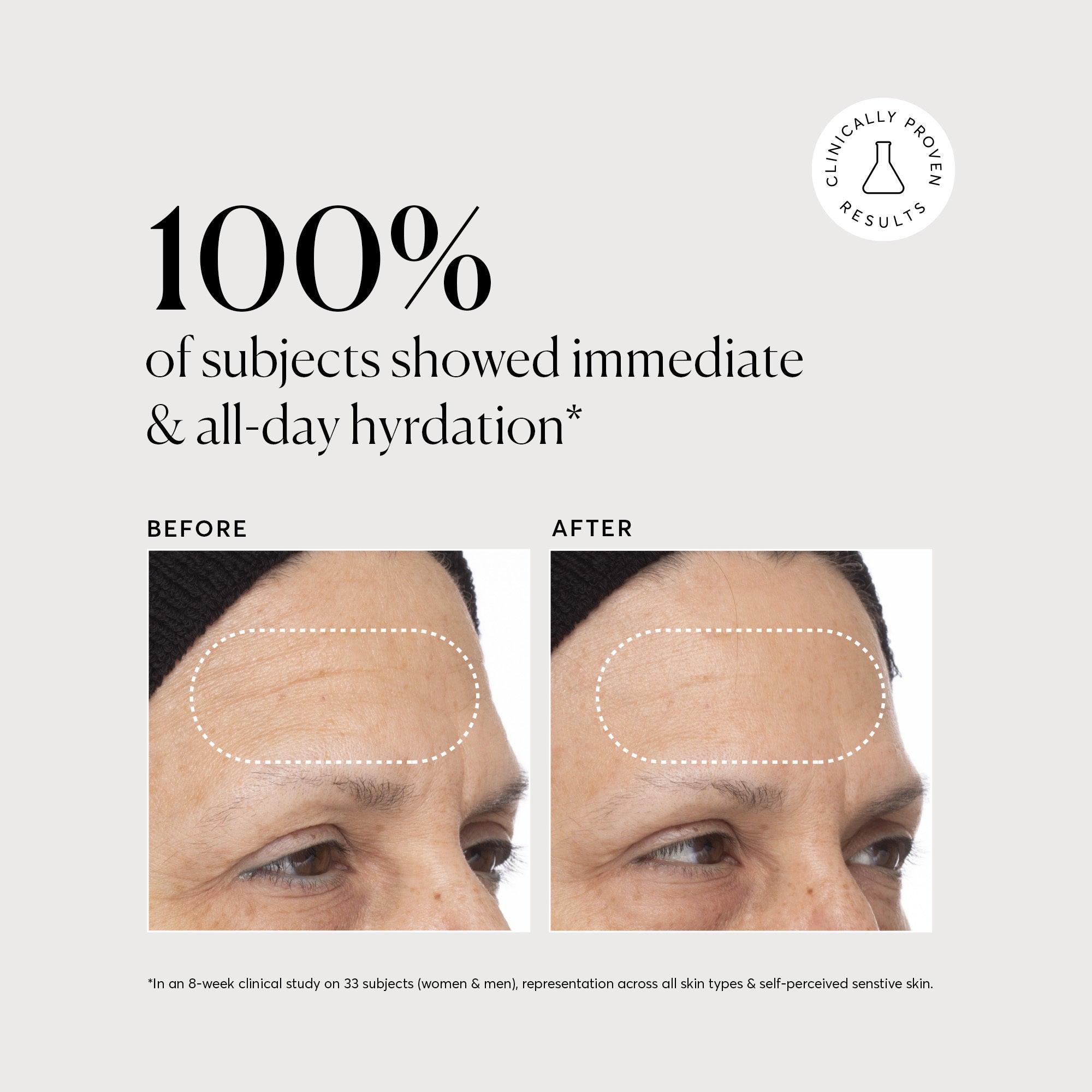 NATR_VitC_Clinical_Graphics_B_A_2_Bone