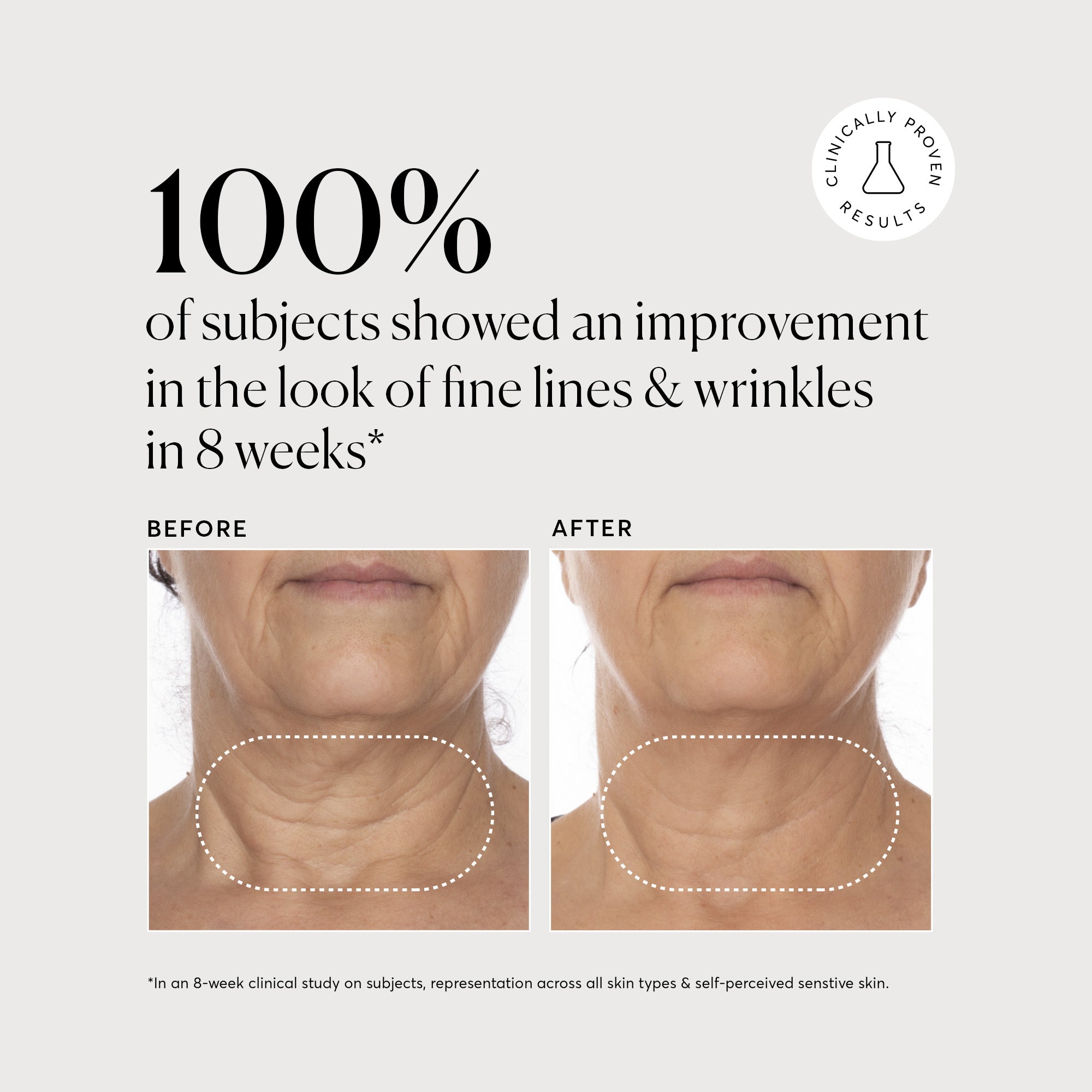 NATR_VitC_Complex_Clinical_Graphics_B_A_FineLines_Bone_978693e9-b950-488c-93c4-d5646f816d12